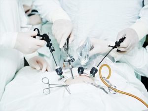 لاپاراسکوپی